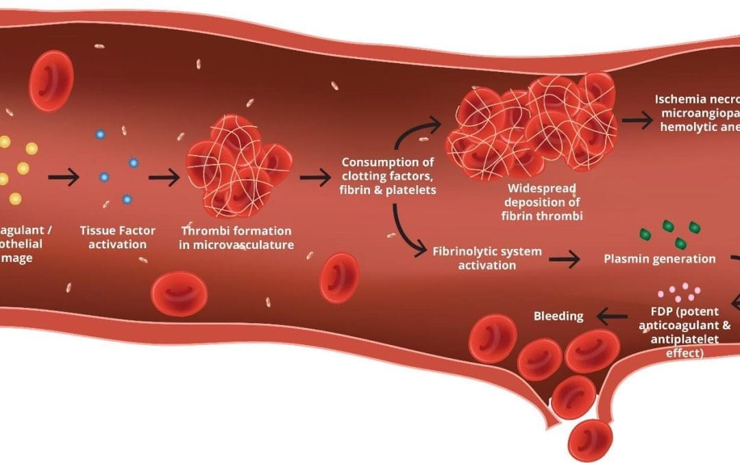 Disseminated Intravascular Coagulation (DIC)