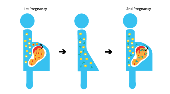 Image depicting a flowchart illustrating the pathogenesis of hemolytic fetal disease of the newborn (HDN) and the anamnestic response in subsequent pregnancies, highlighting the role of Rh incompatibility