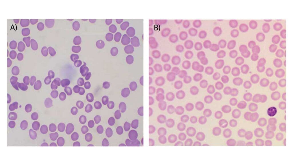 Different zones of a peripheral blood smear.