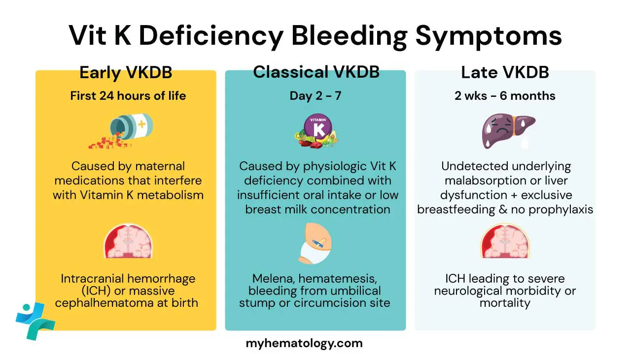 Vitamin K Deficiency Bleeding (VKDB)