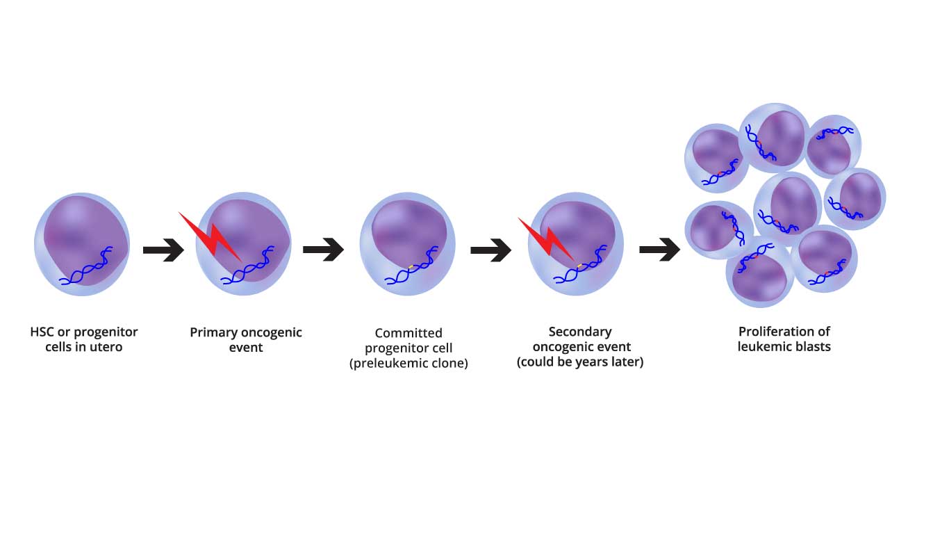 Image illustrating the two-step oncogenic model of AML pathogenesis, including the initial genetic alterations and the subsequent epigenetic and transcriptional changes