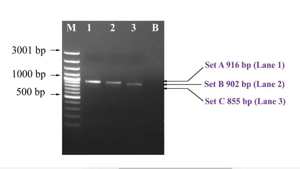 Agarose gel electrophoresis results showing beta-globin gene PCR amplicons.
