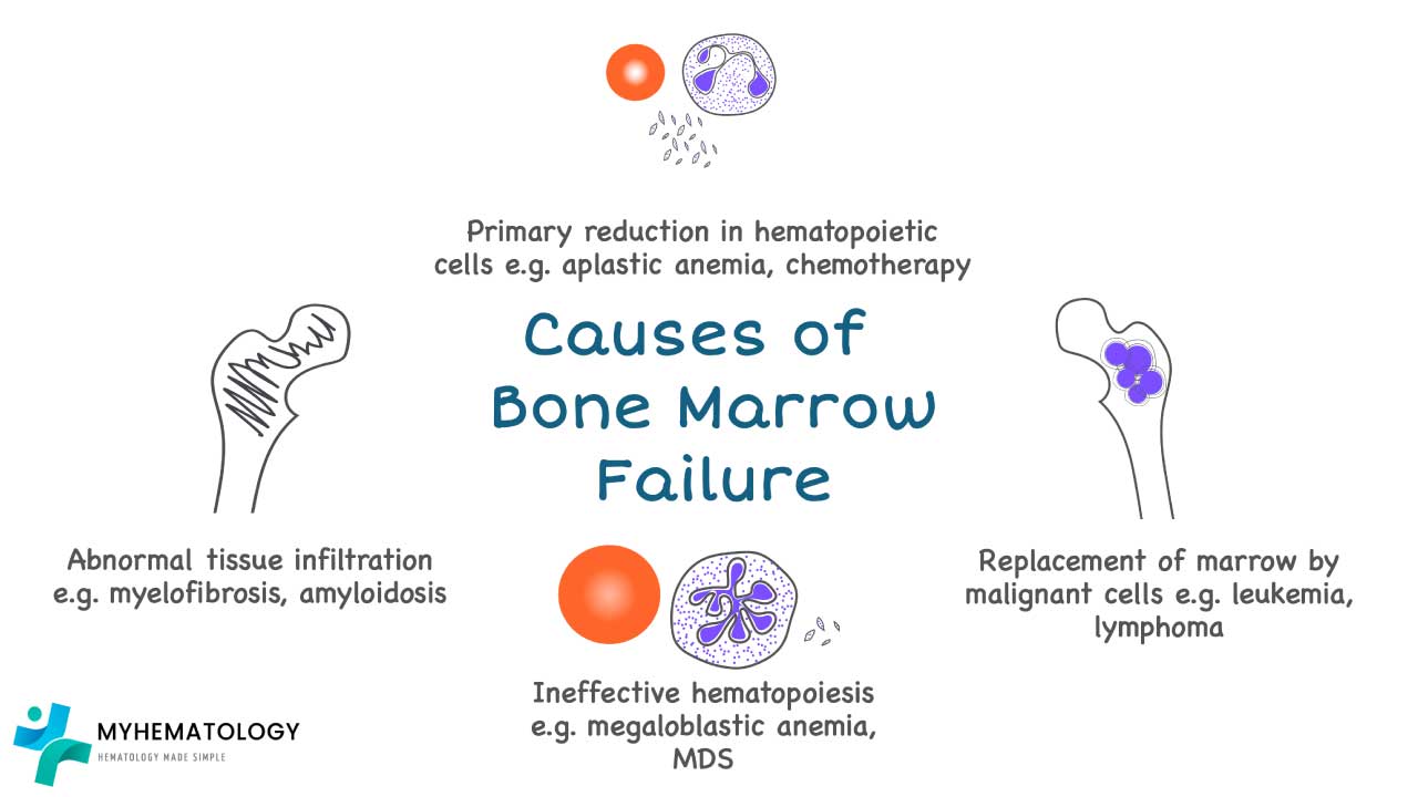 Bone Marrow Failure