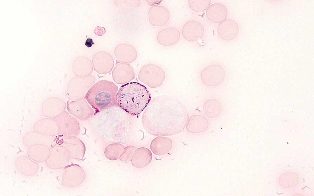 Periodic Acid Schiff Stain (PAS Staining)