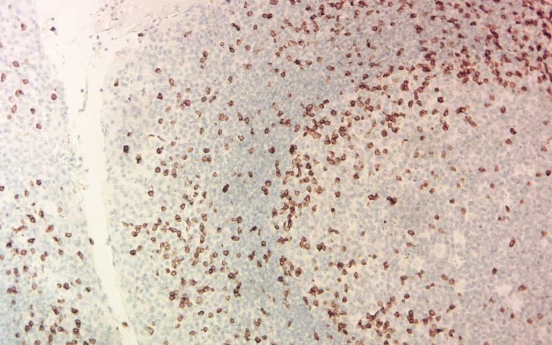 IHC – Immunohistochemistry Staining