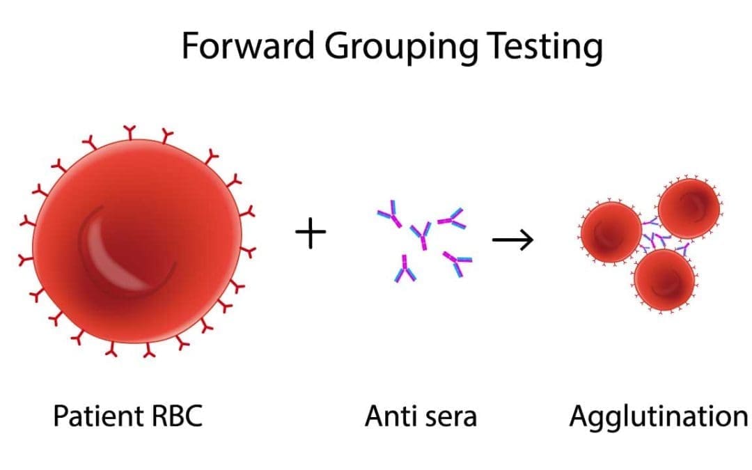 ABO RhD Test (Blood Group Typing) Tube Method