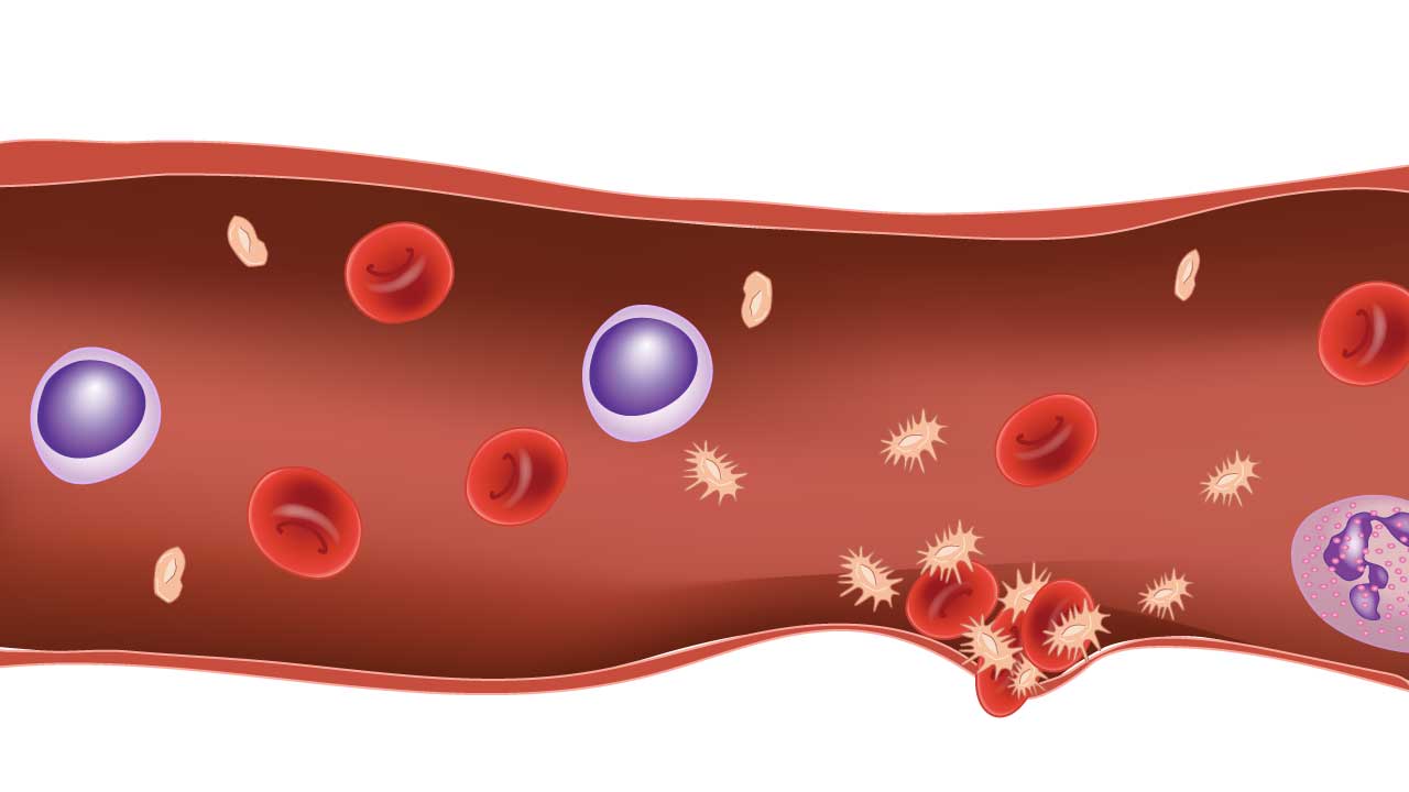 Platelets clumping in primary hemostasis, forming a sticky plug to seal a wound.