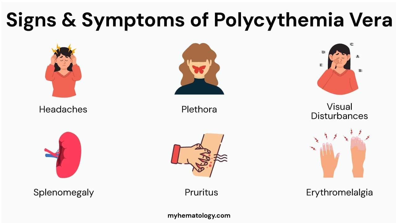 Various symptoms associated with polycythemia vera.