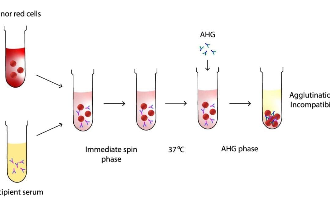 Serologic Crossmatching (Blood Compatibility Test)