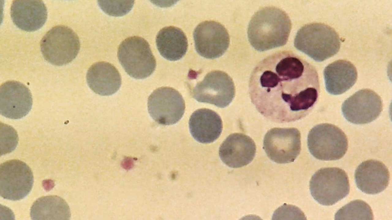 Neutrophils