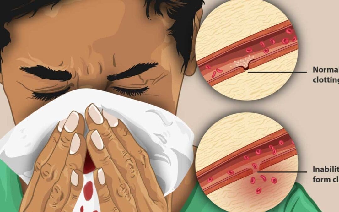 Coagulation (Clotting) Disorders