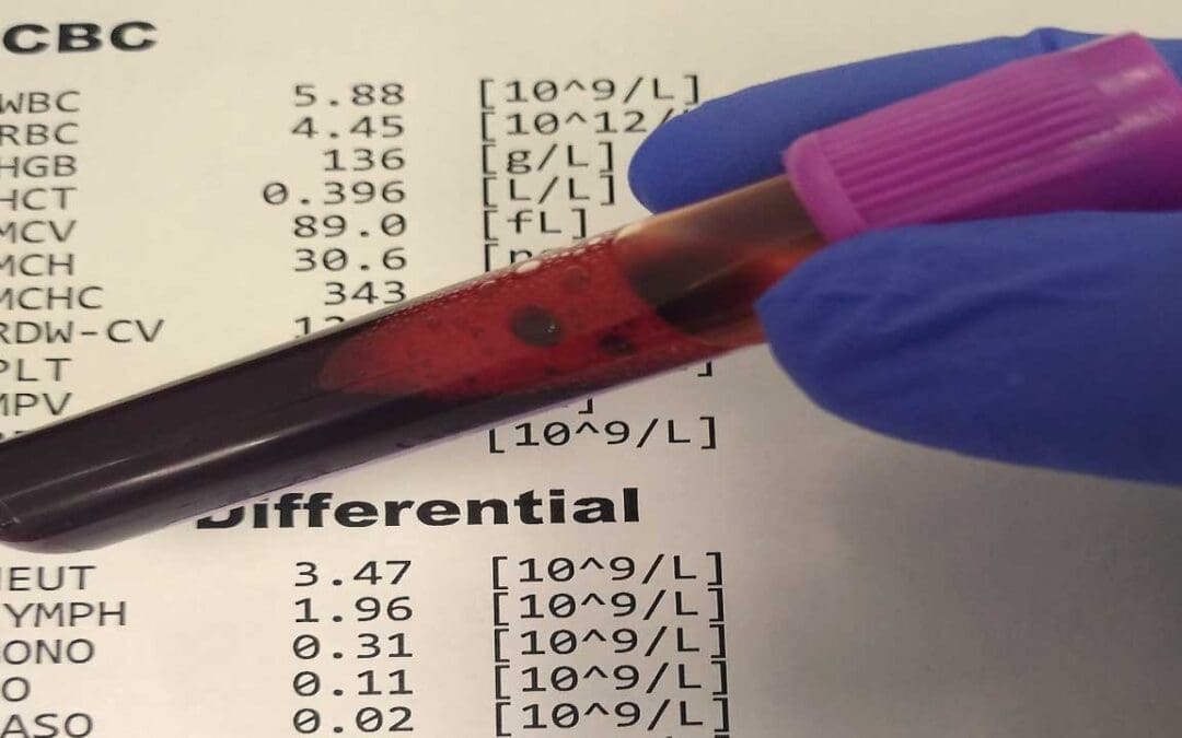 CBC with Differential and Other Reference Ranges