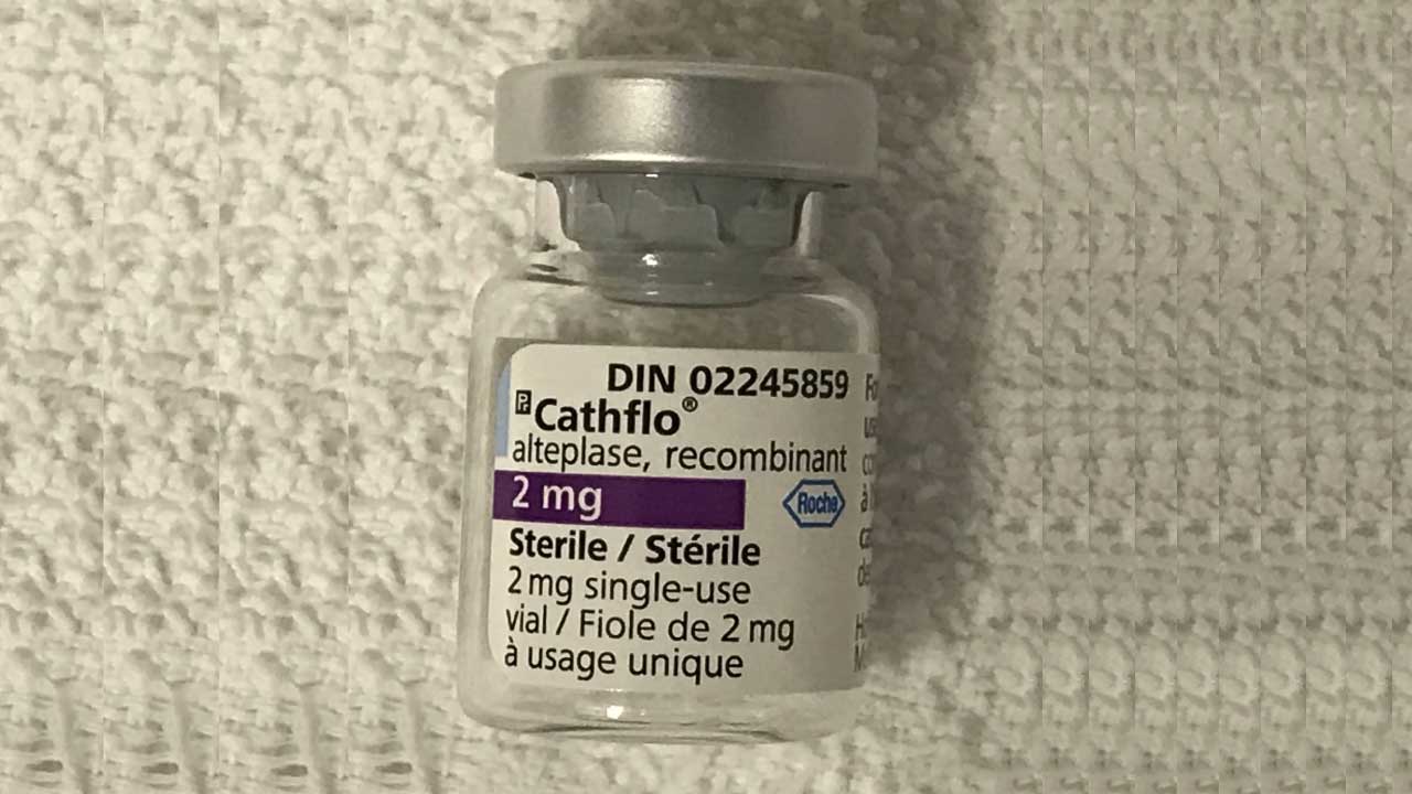 Tissue Plasminogen Activator (tPA)