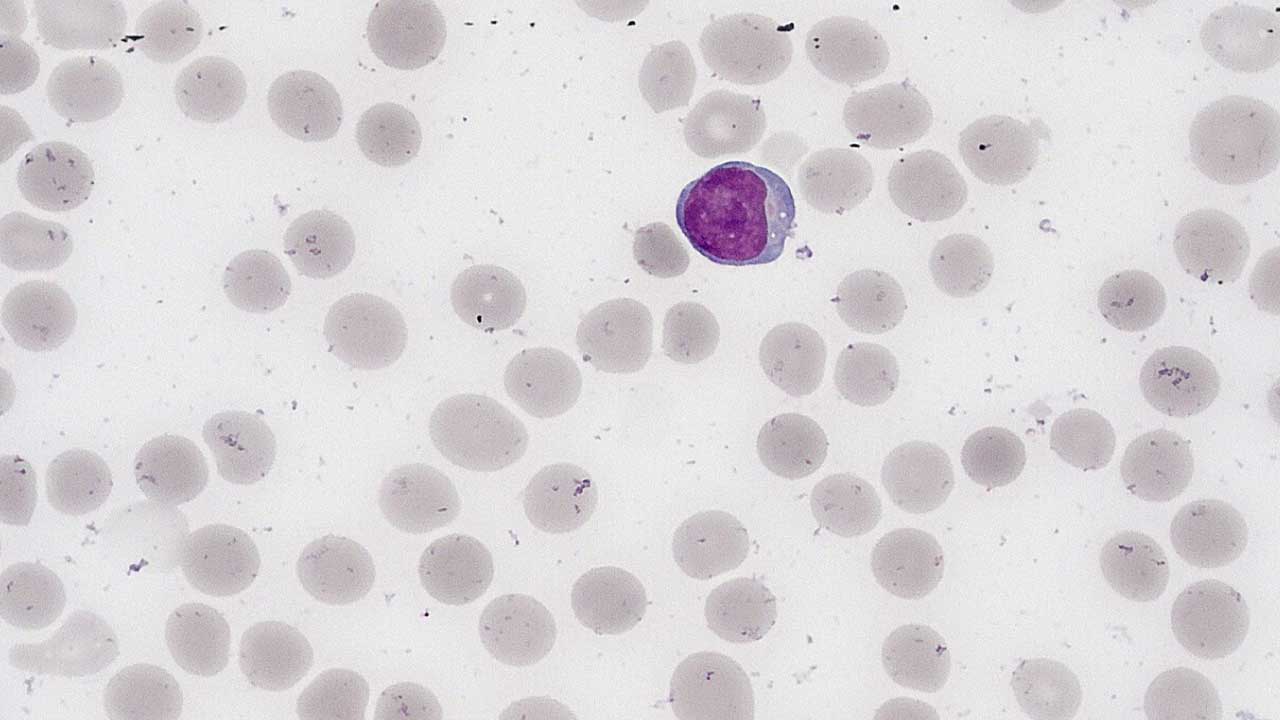Lymphocytes