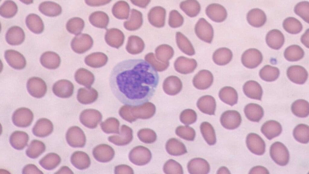 Monocyte in a peripheral blood smear. 