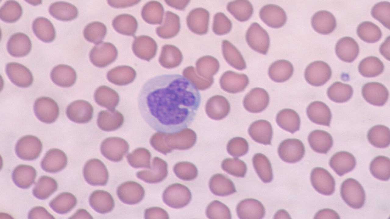 Monocytes