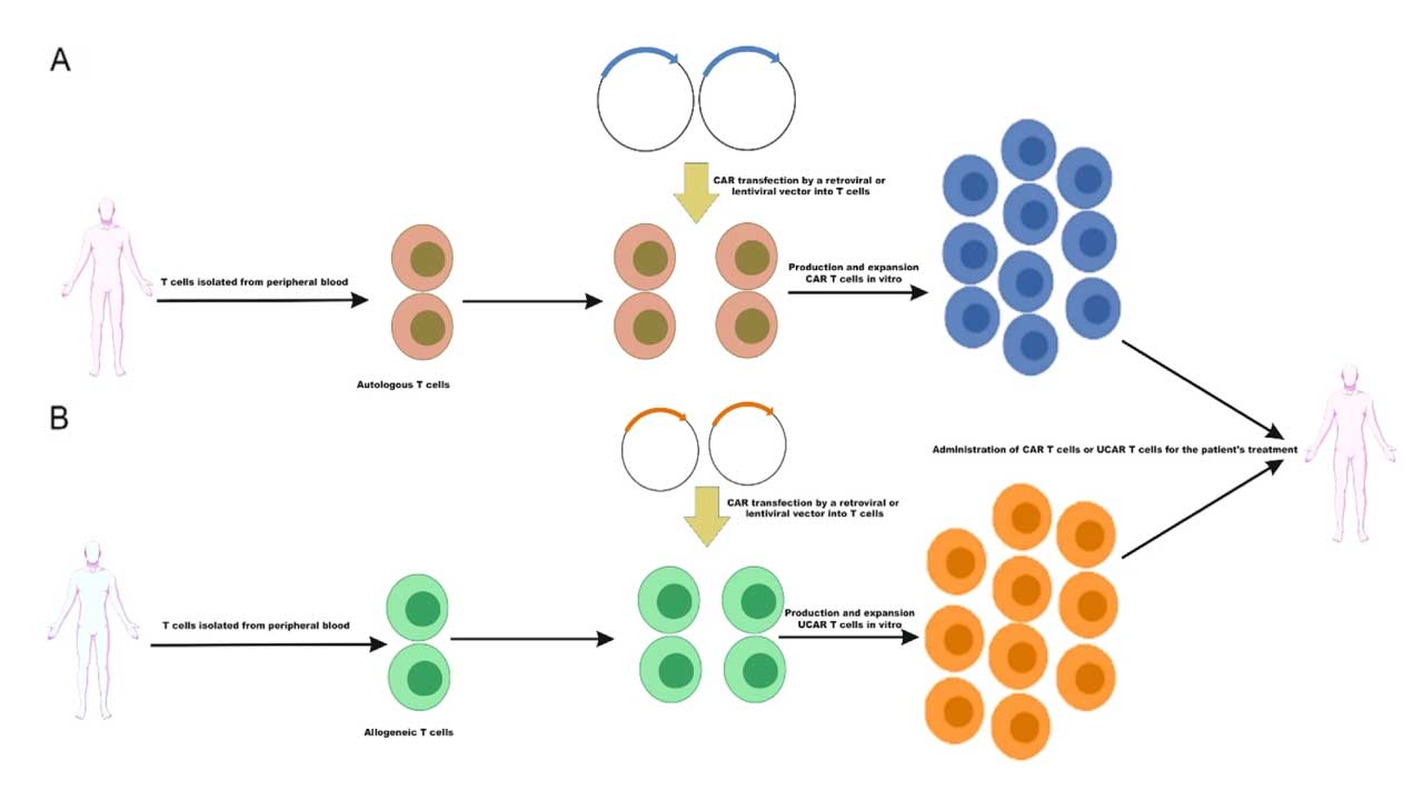 Isolation of peripheral blood T-cell from autologous or allogeneic source for manufacturing and CAR T-cell treatment.
