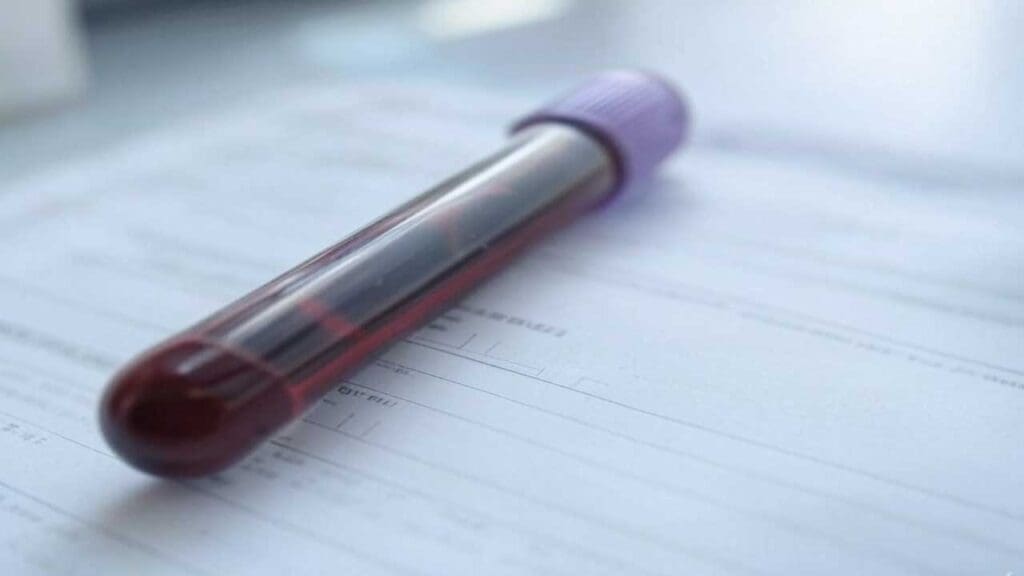 Whole blood is used for folate blood test in folate RBC test while serum is used for folate blood test in vitamin B12 and folate test.