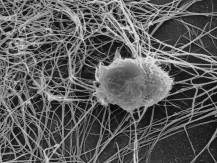 This image shows an isolated follicular dendritic cell (FDC) cultured on collagen. Its cell body extends numerous dendrites that intertwine with those of adjacent FDCs, creating a network. Within lymphoid follicles of secondary lymphoid tissues, these networks trap antigens as immune complexes, facilitating presentation to B cells.