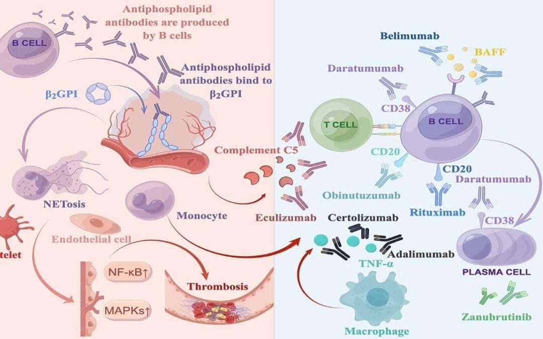 Antiphospholipid Syndrome