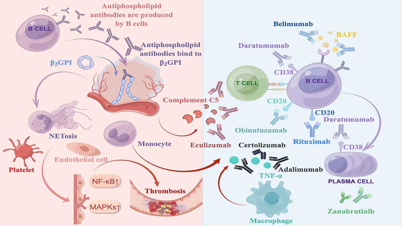 Antiphospholipid syndrome pathogenesis and biologics treatments