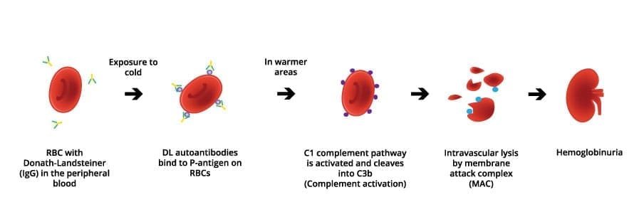 The mechanism of cell lysis (pathophysiology) in paroxysmal cold hemoglobinuria. 
