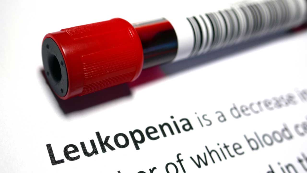 Leukopenia (Low White Cell Count)