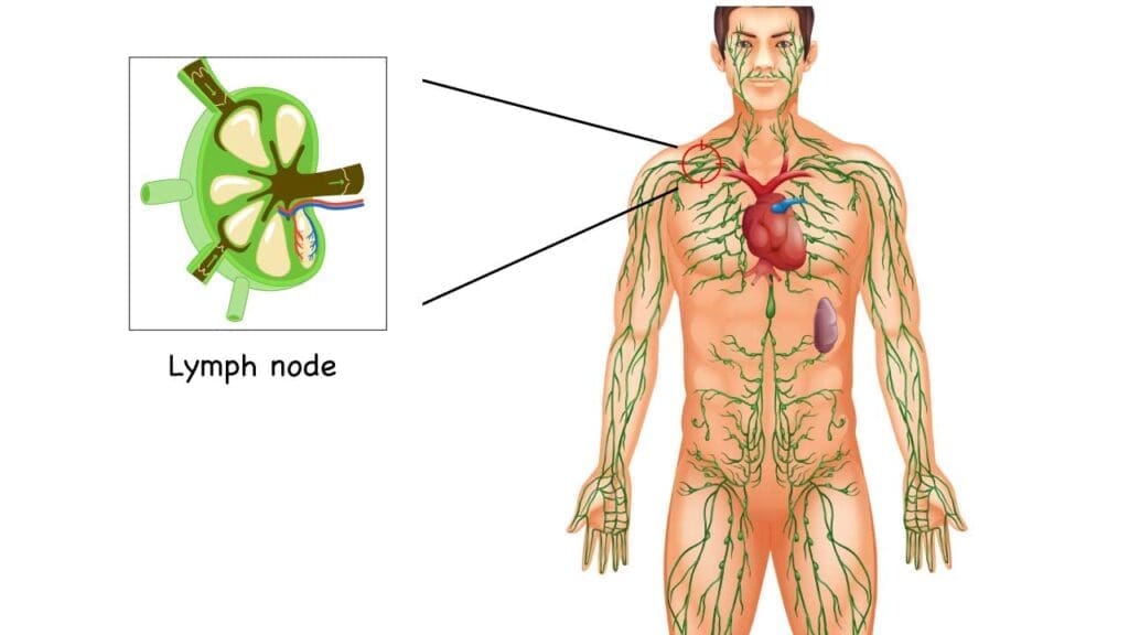 An illustration of the lymphatic system with a simplified anatomical illustration of a lymph node (inset).