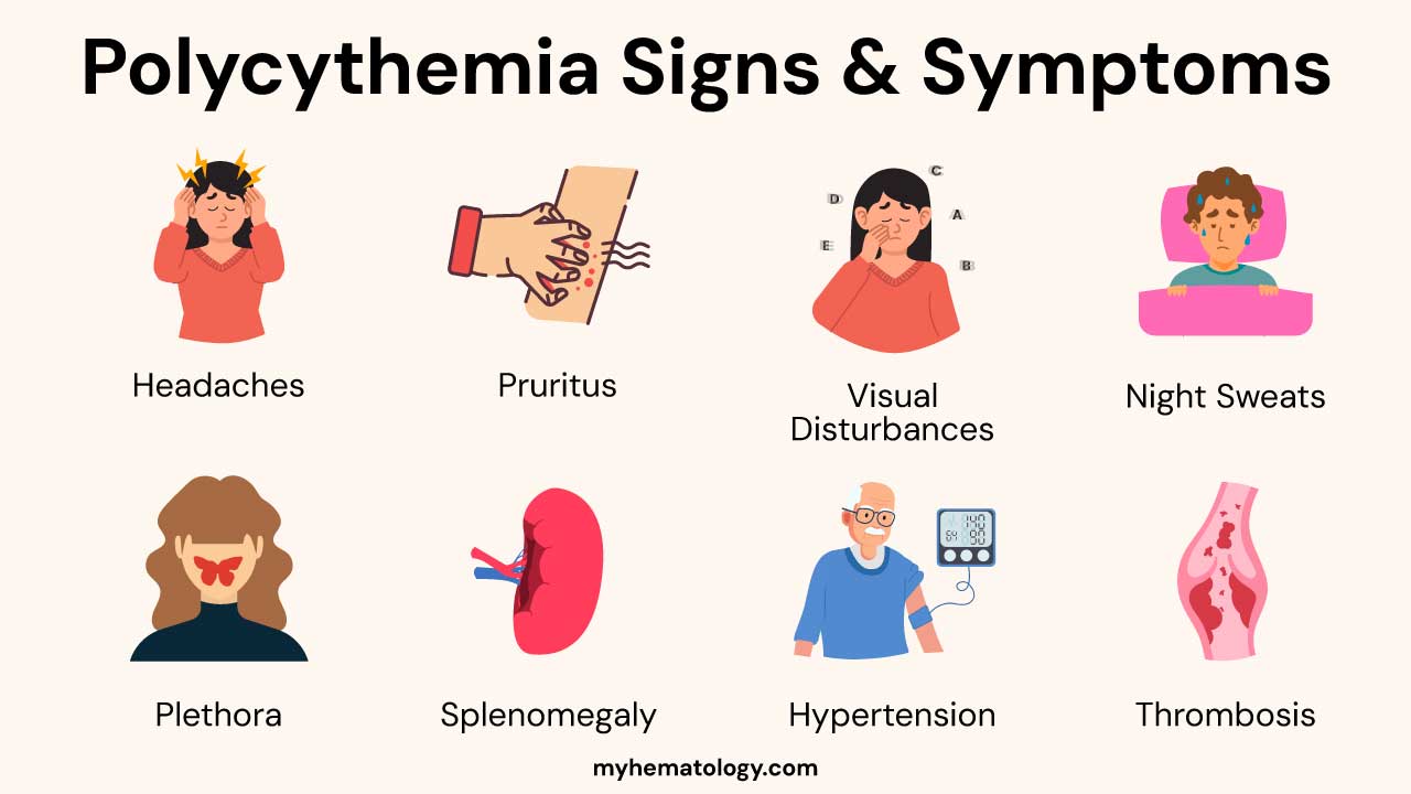 Common signs and symptoms of polycythemia