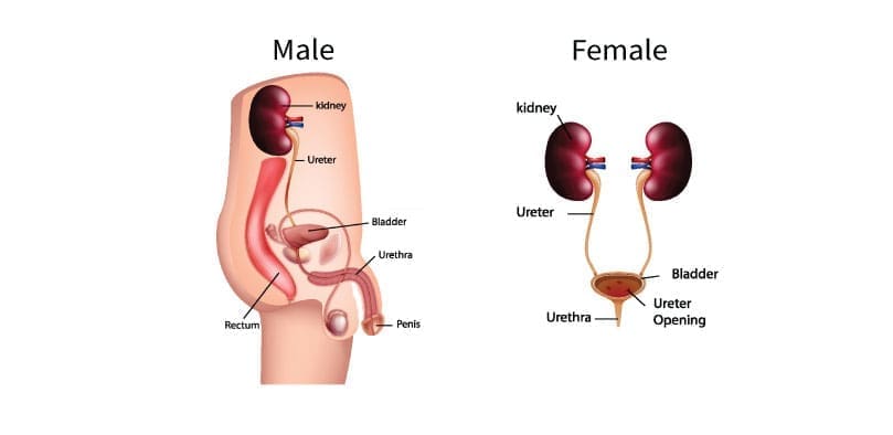 Hematuria (Blood in Urine): Overview & Causes