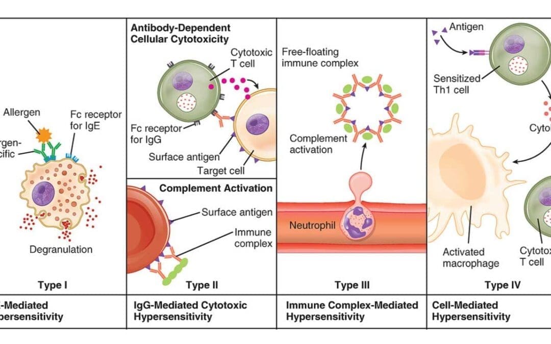 Hypersensitivity Reactions: Causes and Mechanisms