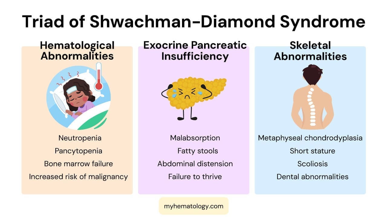 Shwachman-Diamond Syndrome (SDS)