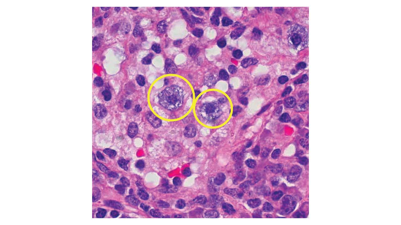Mast Cell