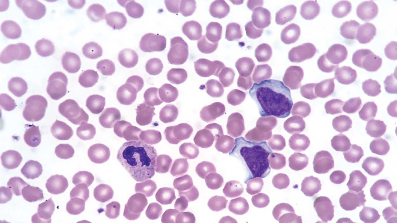 Wright Stain for Peripheral Blood Smear
