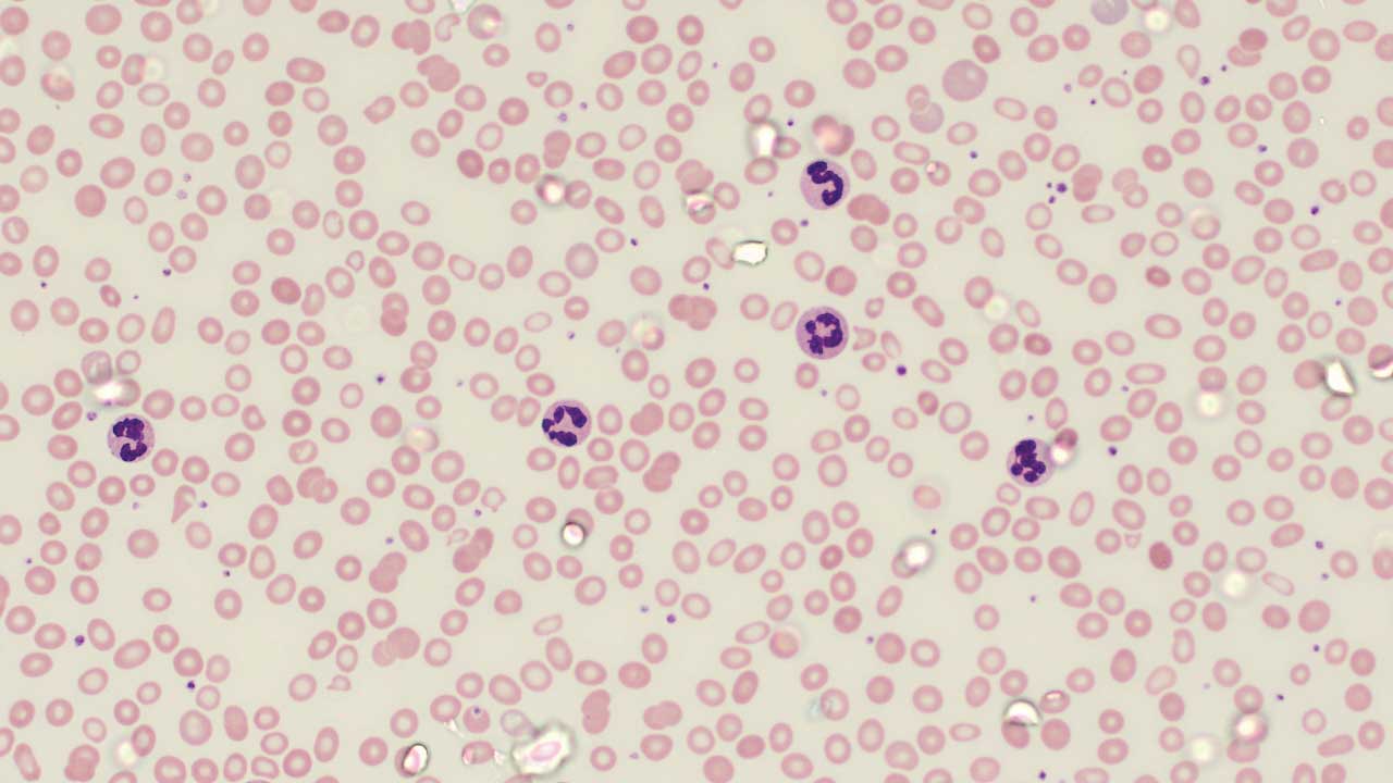 Wright-Giemsa Stain