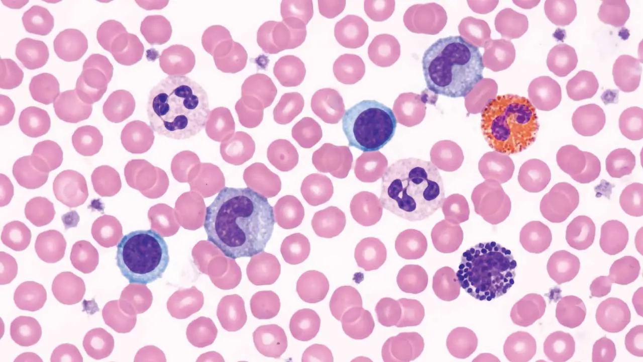 Wright-Giemsa Stain