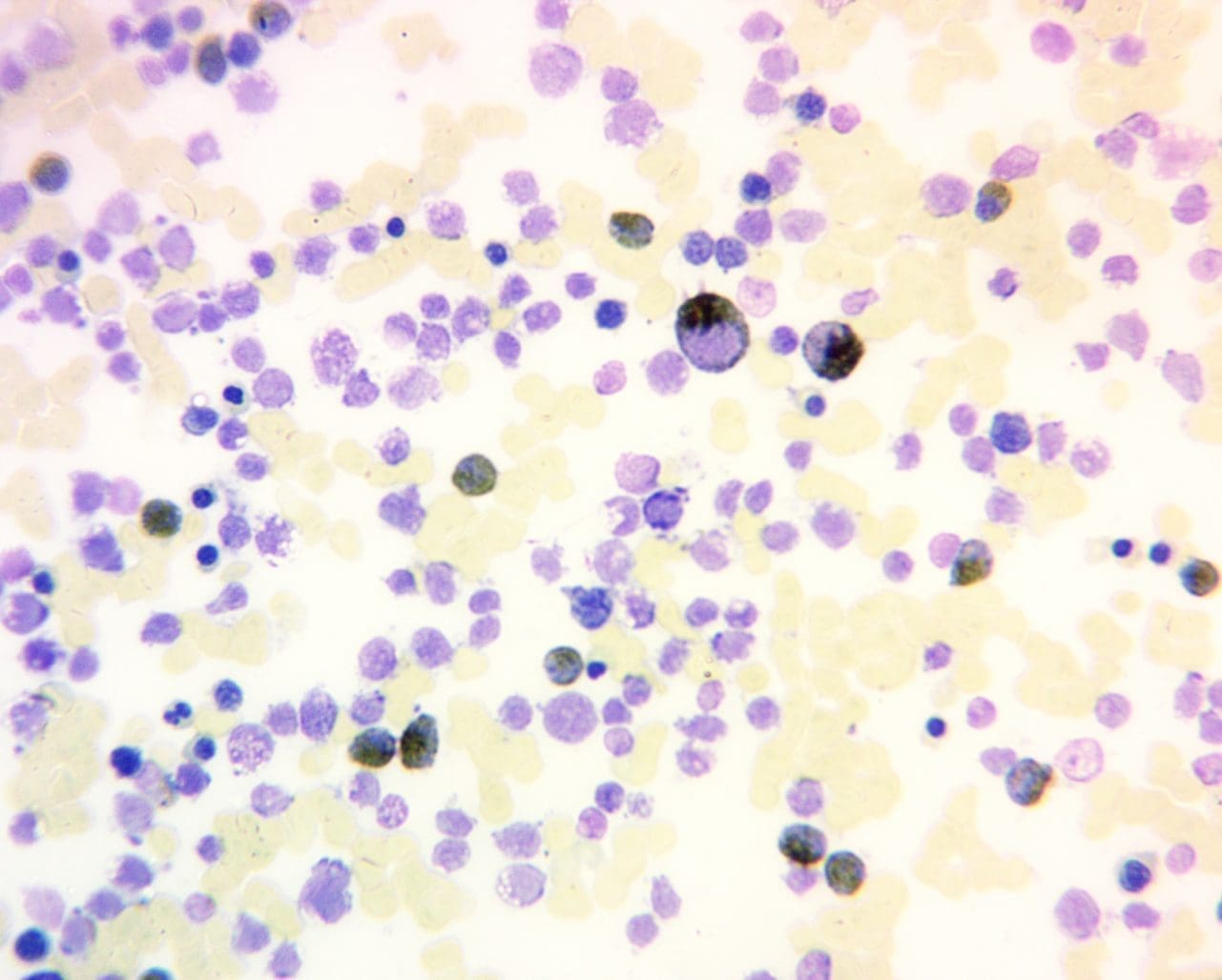 Myeloperoxidase Reaction (MPO) Stain