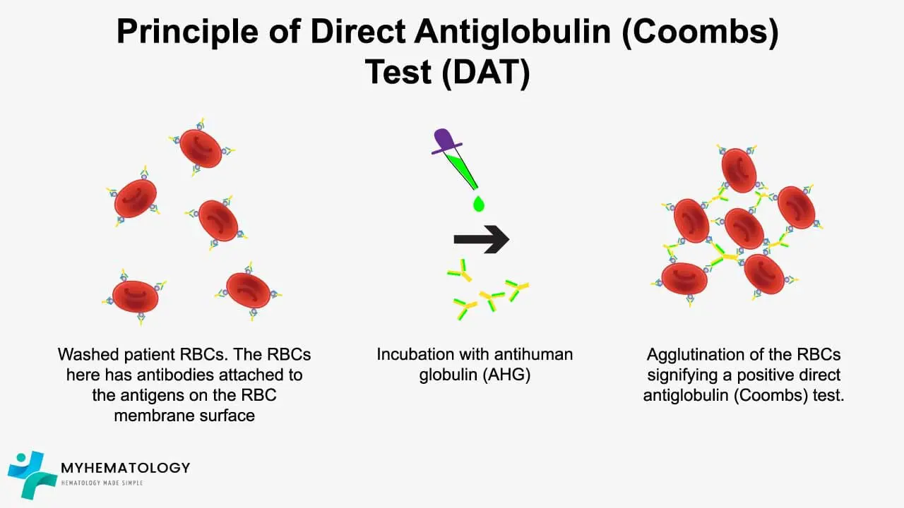 Direct Antiglobulin (Coombs) Test (DAT)