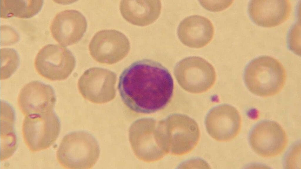 A small lymphocyte in the peripheral blood smear. Lymphocytes are the second most abundant type of white blood cells or WBCs.