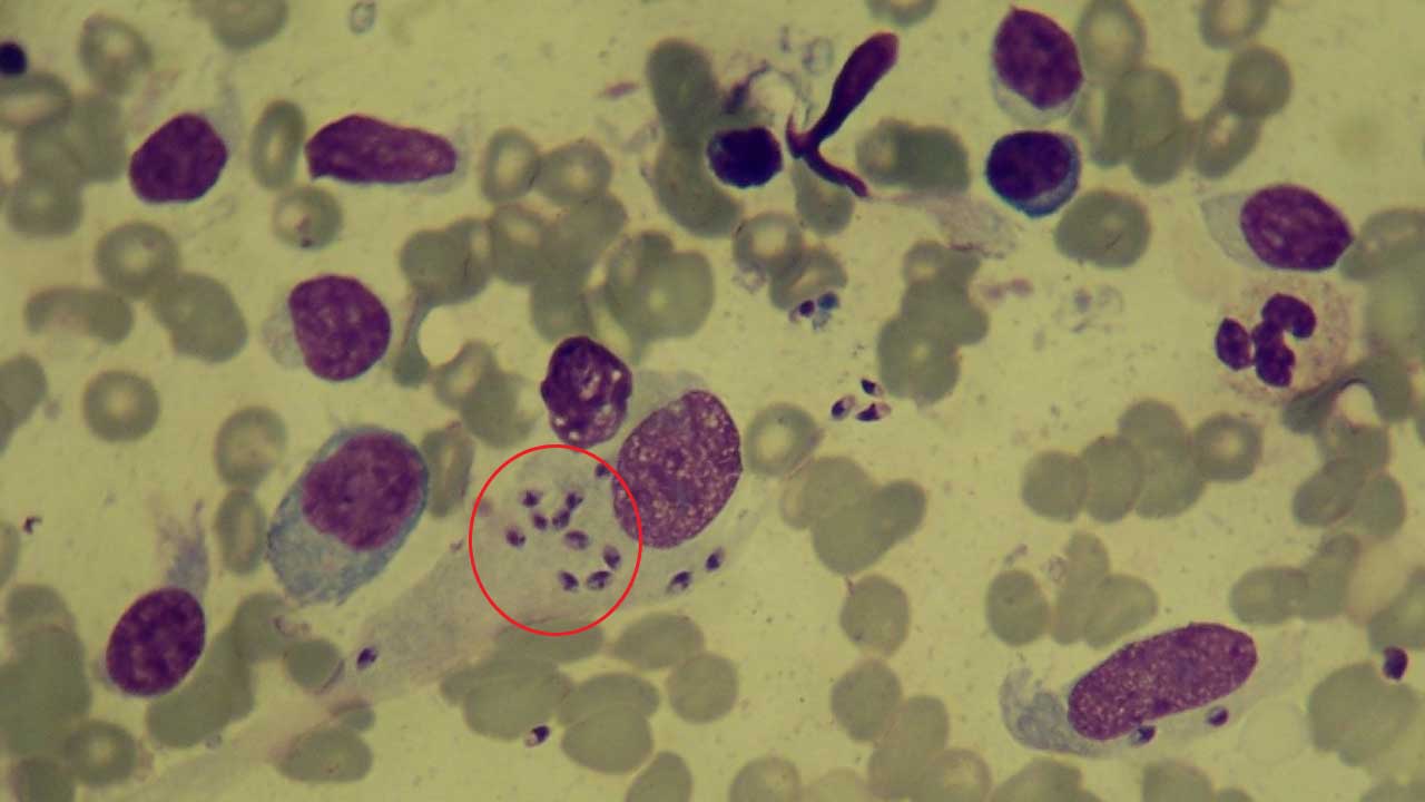Preparation of Thick Blood Films for Parasites