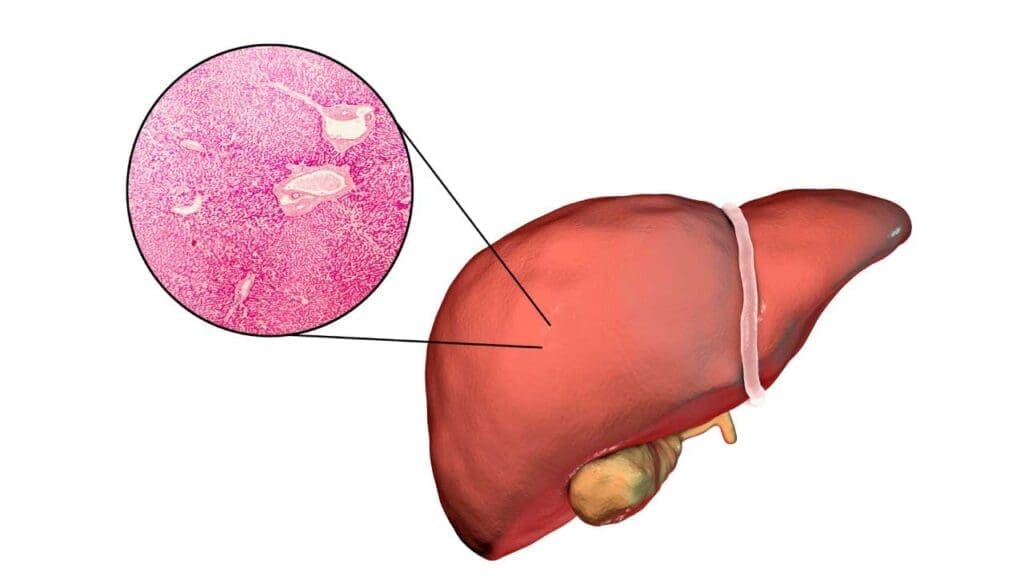 An illustration of the liver with an inset of a micrographic image of hepatocytes from the parenchyma of a liver lobule. 